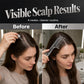 💆‍♀️🌿 Peigne applicateur de soin du cuir chevelu – 6 dents, embouts roulants, PC + silicone + métal, masse et répartit vos soins capillaires en un geste précis, pour des racines saines et apaisées 💧✨